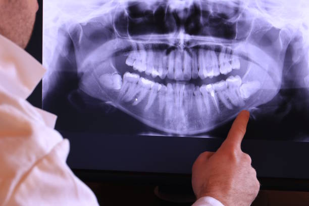 Best Emergency Dental Care for Broken or Chipped Teeth in Cortland, OH